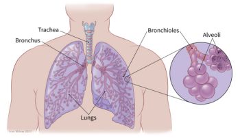 Everything You Need To Know About lung cancer- Overview, Symptoms, and Treatment