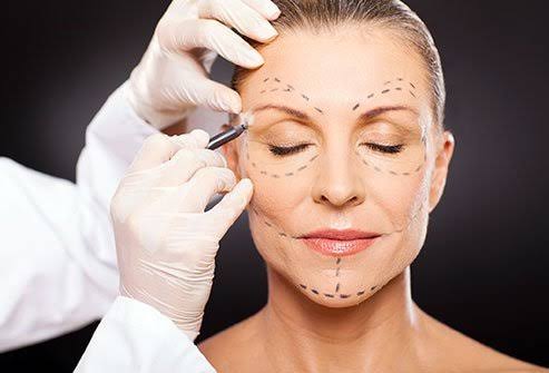 5 Things to know before going for a plastic surgery 