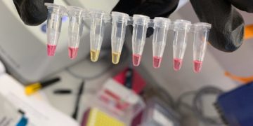 LAMP-covid-test-result-in-30-minutes