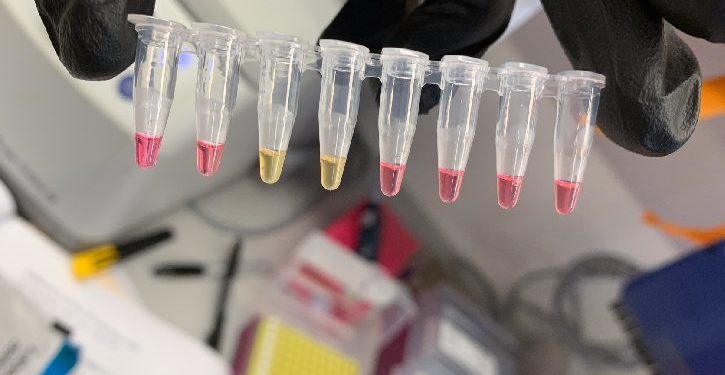 LAMP-covid-test-result-in-30-minutes