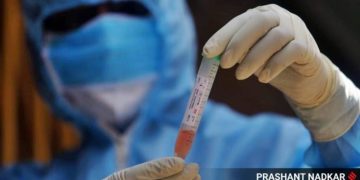 RT-PCR-test-Haryana-price-reduce