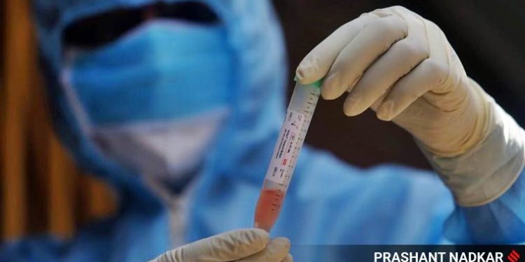 RT-PCR-test-Haryana-price-reduce