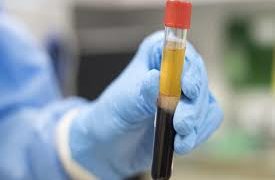 World’s top medical journal claims plasma therapy offers no mortality benefit