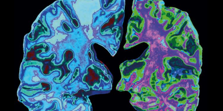 Alzheimer’s Study: A Mediterranean diet might reduce the danger of dementia.