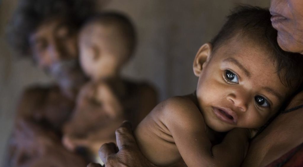 Child Malnutrition; A Menace To India For Decades