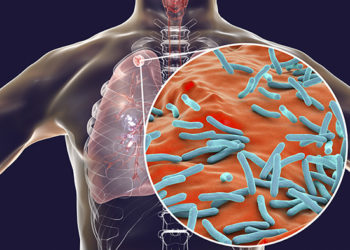 How has TB conquered your body?