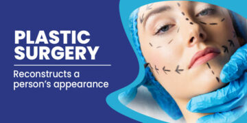 5 Things to know before going for a plastic surgery