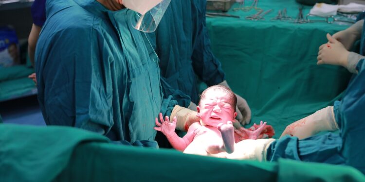 Cesarean Section (C-Section): Trusting Birth - The Healthcare Daily